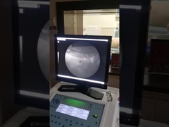 Macchina ad onde d' urto extracorporee ad alta precisione, sistema di raggi X di litoripsia a velocità di urto.