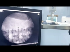 Macchina ad onde d'urto extracorporee ad alta frequenza con applicatore focalizzante 1-16Hz 100W